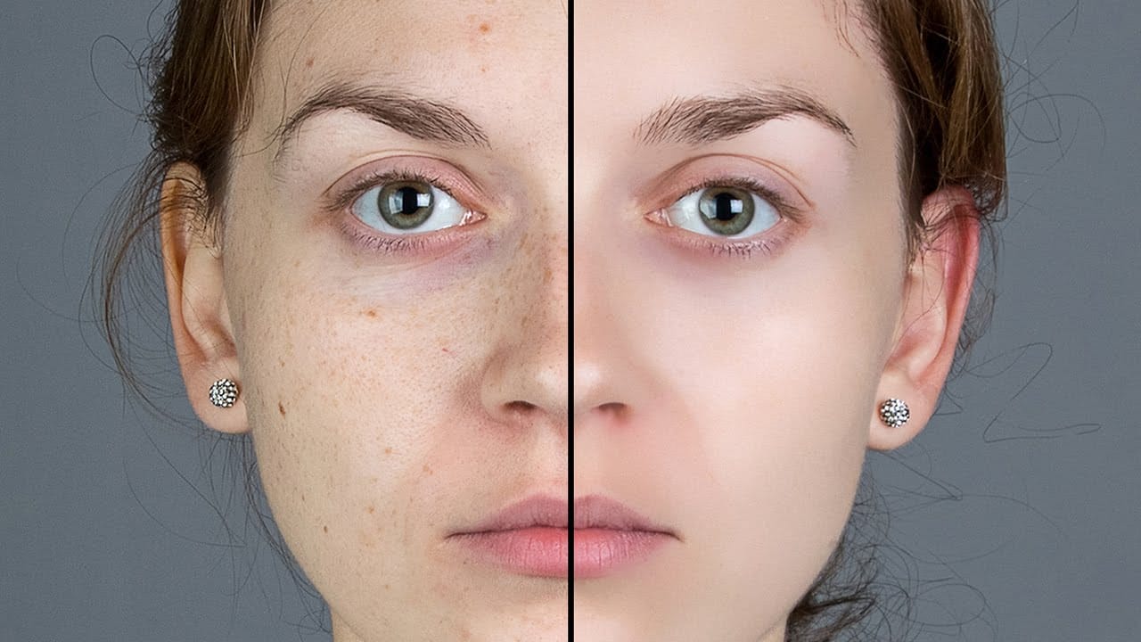 Smooth Skin and Remove Blemishes and Scars in Photoshop